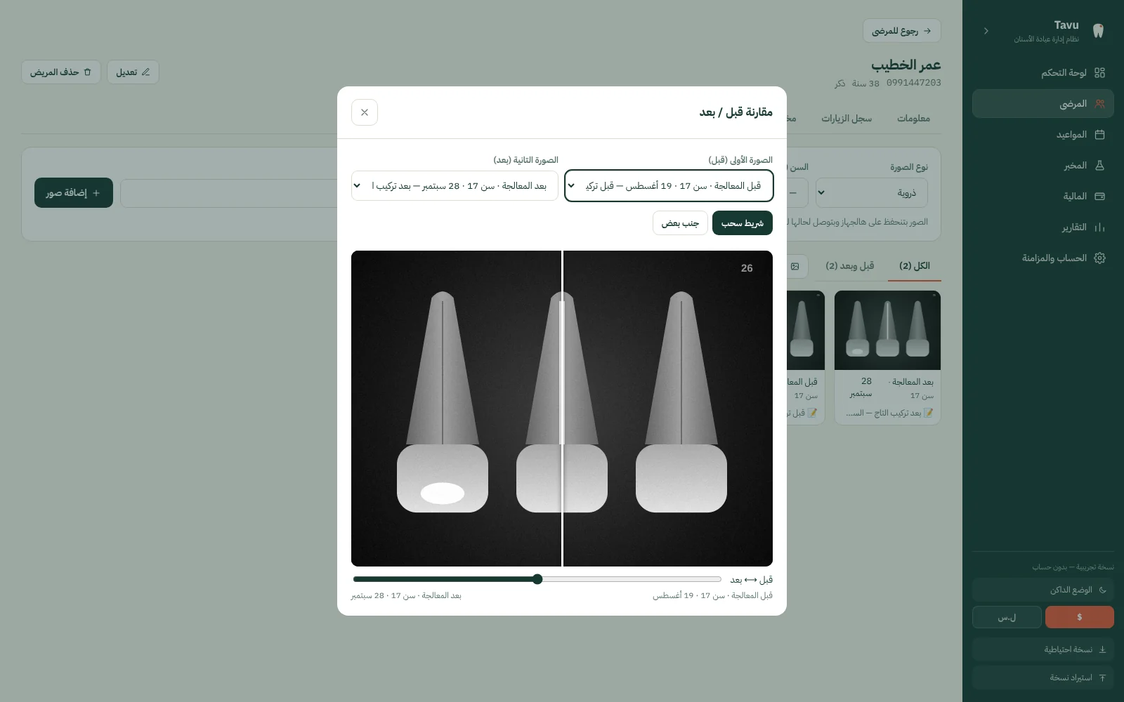 صور المريض وأشعته في ملفه، مع مقارنة قبل العلاج وبعده بشريط سحب.